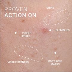 Corrective Serum Blemish Prone Skin, , large, image7