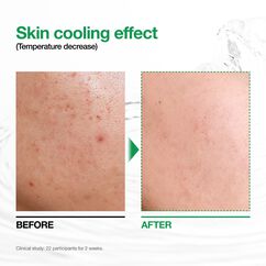 Heartleaf 77 Soothing Toner, , large, image7