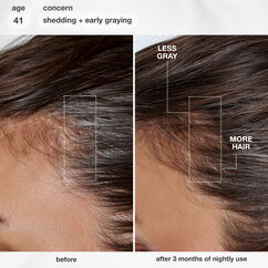 Future IQ&trade; Biomimetic Hair Longevity Serum, , large, image6