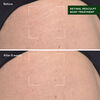Retinal ReSculpt Body Treatment, , large, image4