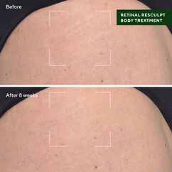 Retinal ReSculpt Body Treatment, , large, image4