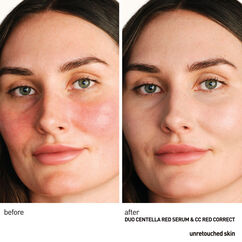 Centella Red Serum, , large, image3