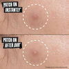 Truly Targeted Overnight Blemish Patch, , large, image5