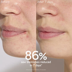 Vinopure Blemish Control Salicylic Serum, , large, image3