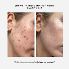 Clarity Kit, , large, image4