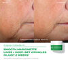 Retinal ReSculpt Discovery, , large, image9