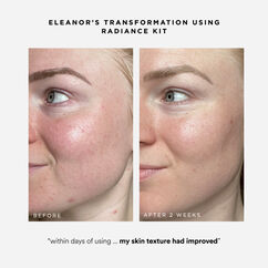 Radiance Kit, , large, image4