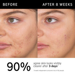 Salicylic Acid Cleanser, , large, image4