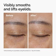 Lacto-PDRN 4% B9 Eye Cream, , large, image3