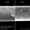 Reconstructing Treatment Mask, , large, image6