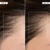 Density Preserving Scalp Drops, , large, image6