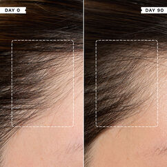 Density Preserving Scalp Drops, , large, image6