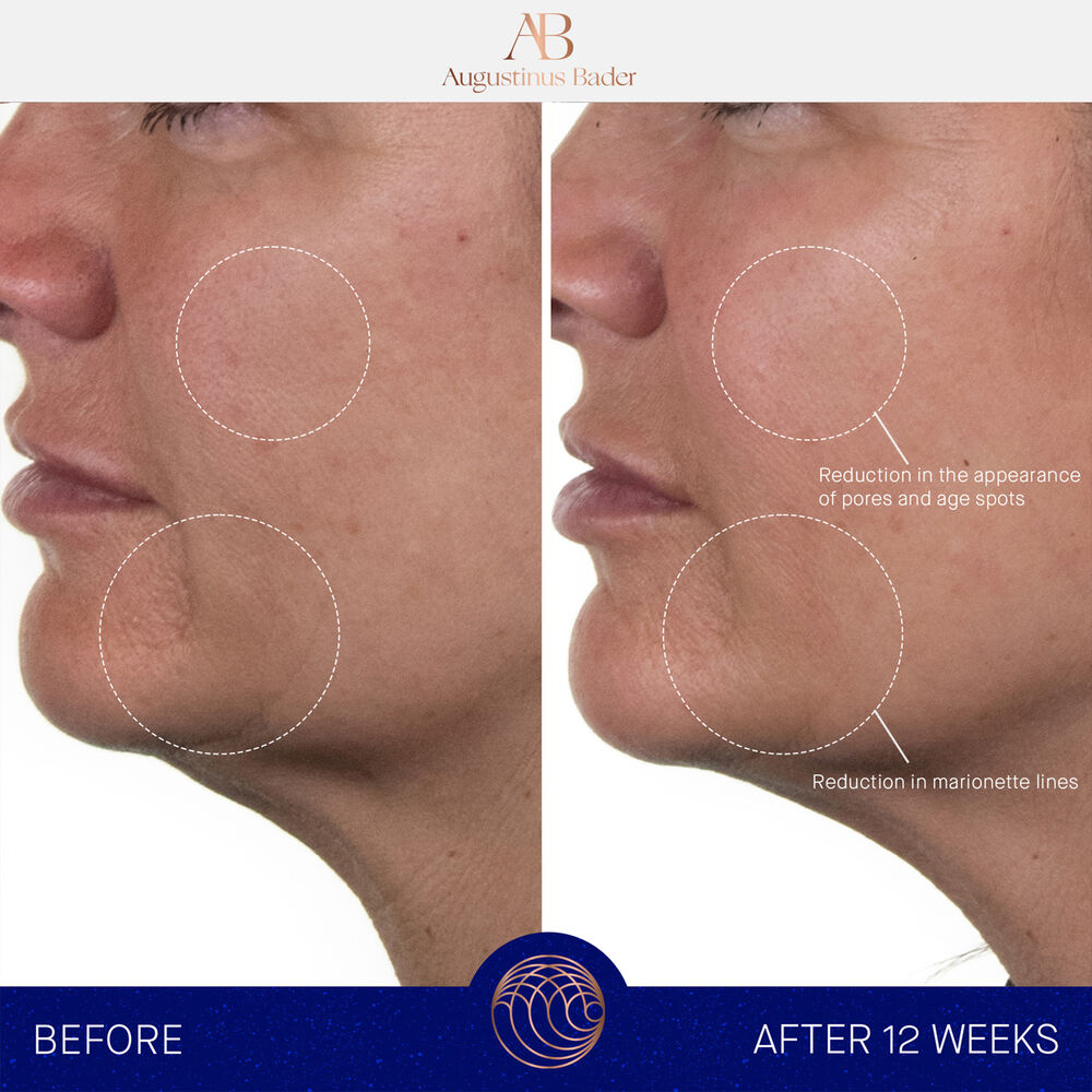 Augustinus Bader The Rich Cream Space NK