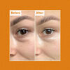 Brightening Skin and Eye Duo, , large, image2