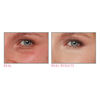 Bye Bye Under Eye Illumination Concealer, MEDIUM 20.0 12ML, large, image3