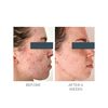 Violet Water Clearing Cleanser Blemish Control Facial Cleansing Gel, , large, image8