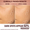 Dark Spot Correcting Radiance Recovery Serum, , large, image3