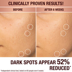 Dark Spot Correcting Radiance Recovery Serum, , large, image3