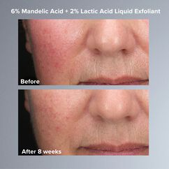 6% Mandelic Acid + 2% Lactic Acid Liquid Exfoliant, , large, image6