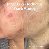 Star Bright Vitamin C Discolouration Correcting Serum, , large, image7