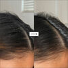 Scalp Revival&trade; Charcoal + Tea Tree Buildup Detox Spray, , large, image3