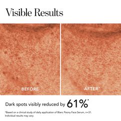 Blanc Peony Face Serum Dark Spot Corrector, , large, image7