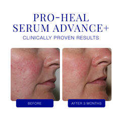 Pro-Heal Serum Advance+, , large, image7