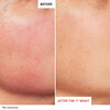 Skin Therapy Duo, , large, image5