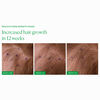 Growth Phase, , large, image4