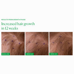 Growth Phase, , large, image4
