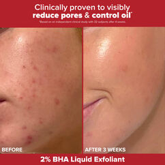 The Breakout Resolution, , large, image7