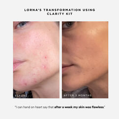 Clarity Kit, , large, image6