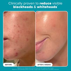 Skin Perfecting 2% BHA Liquid Exfoliant, , large, image10