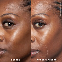 Double Rewind 0.3% Pro-Grade Retinol Serum, , large, image6