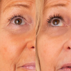Eyelash Growth Serum, , large, image3