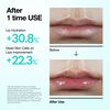 PDRN Lip Serum, , large, image7