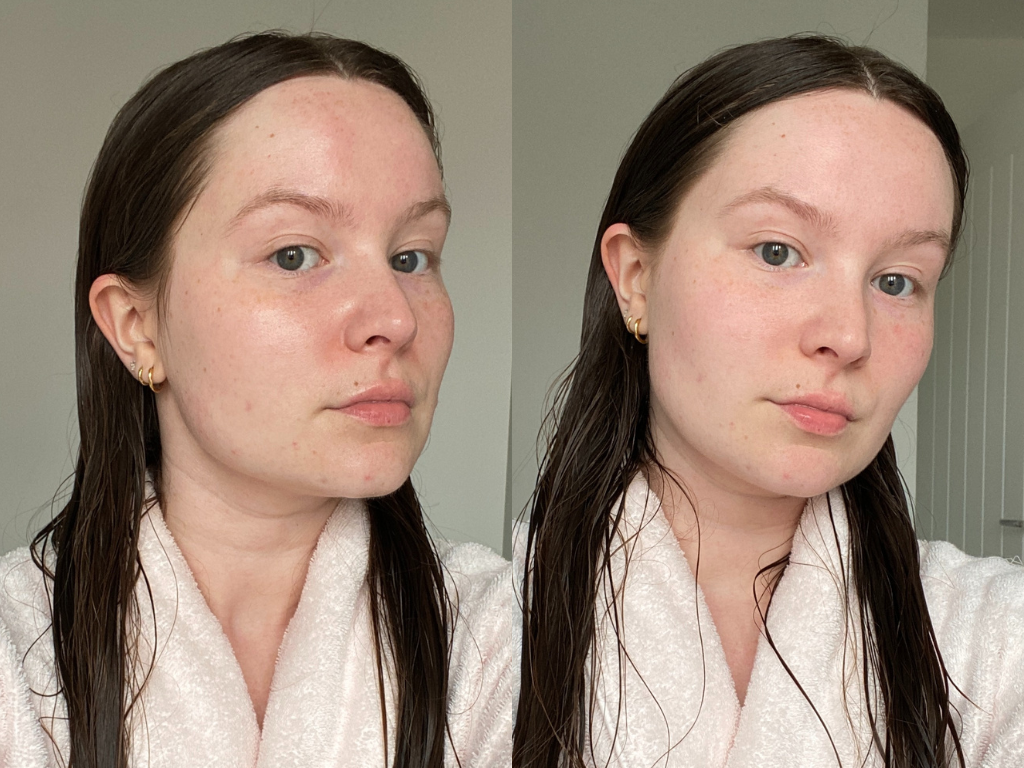 Before and after Caudalie Vinoperfect Serum | Space NK Before and after Caudalie Vinoperfect Serum | Space NK