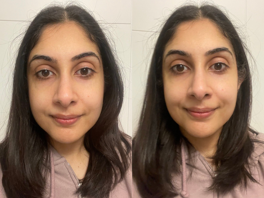 Before and after using Dr Dennis Gross peel pads | Space NK Before and after using Dr Dennis Gross peel pads | Space NK