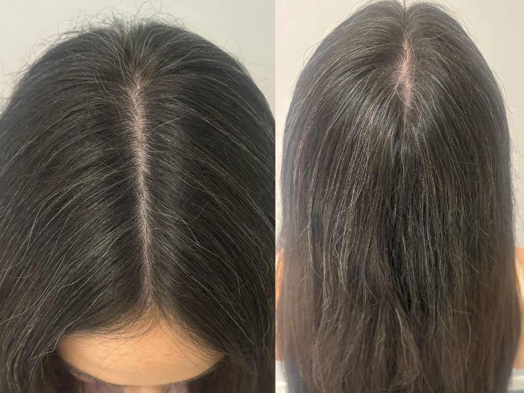 Ella at the start of her K18 hair serum journey Ella at the start of her K18 hair serum journey
