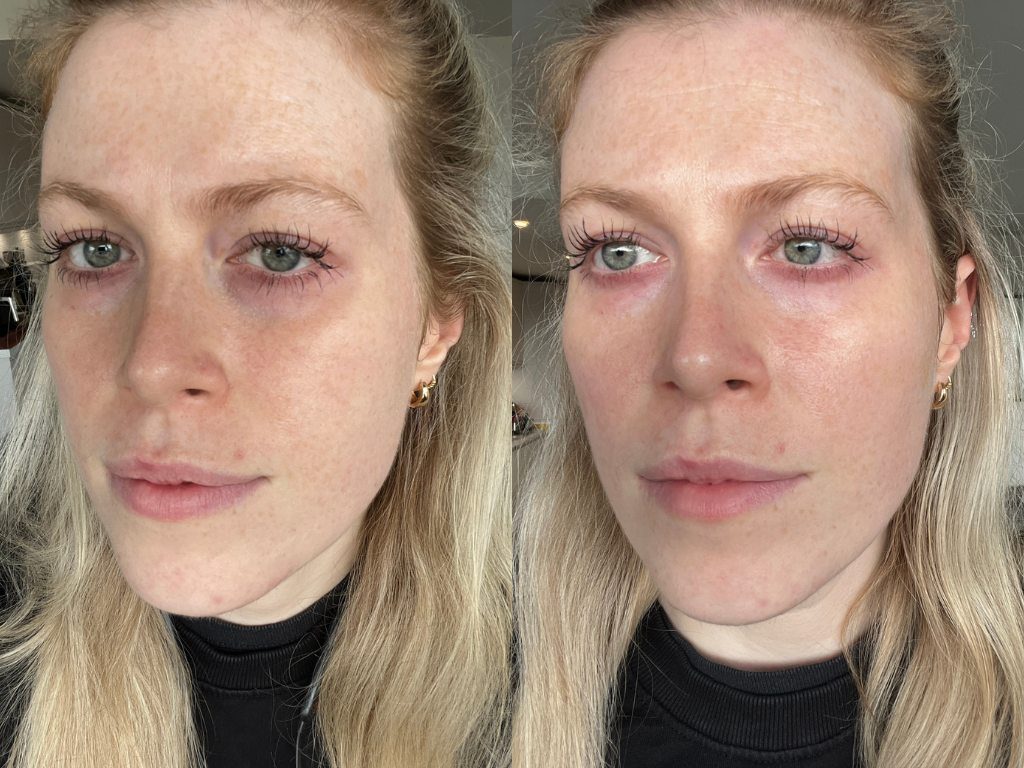 Dr Dennis Gross DermInfusions Eye Mask Before and After | Space NK