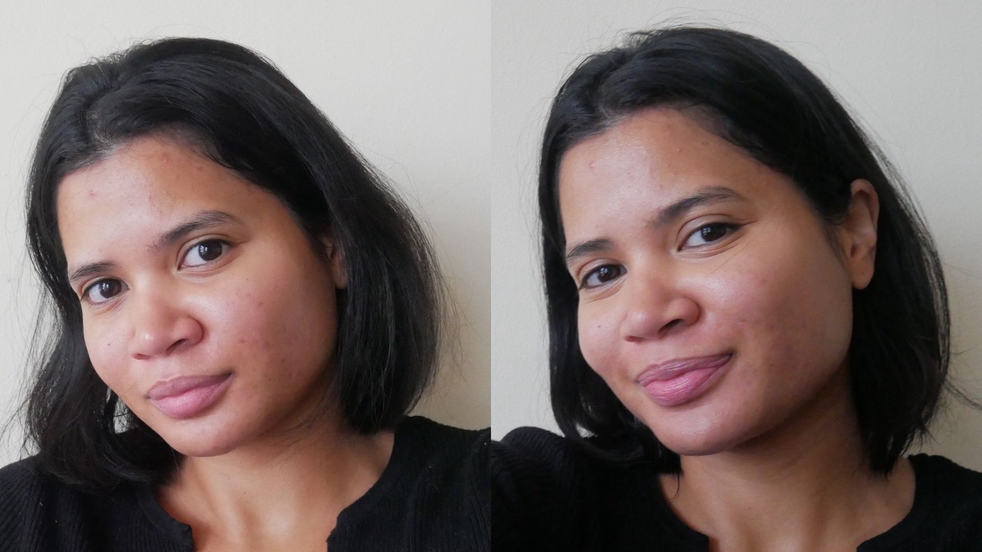Hanitra before and after using The Ordinary Multi-Active Delivery Essence | Space NK