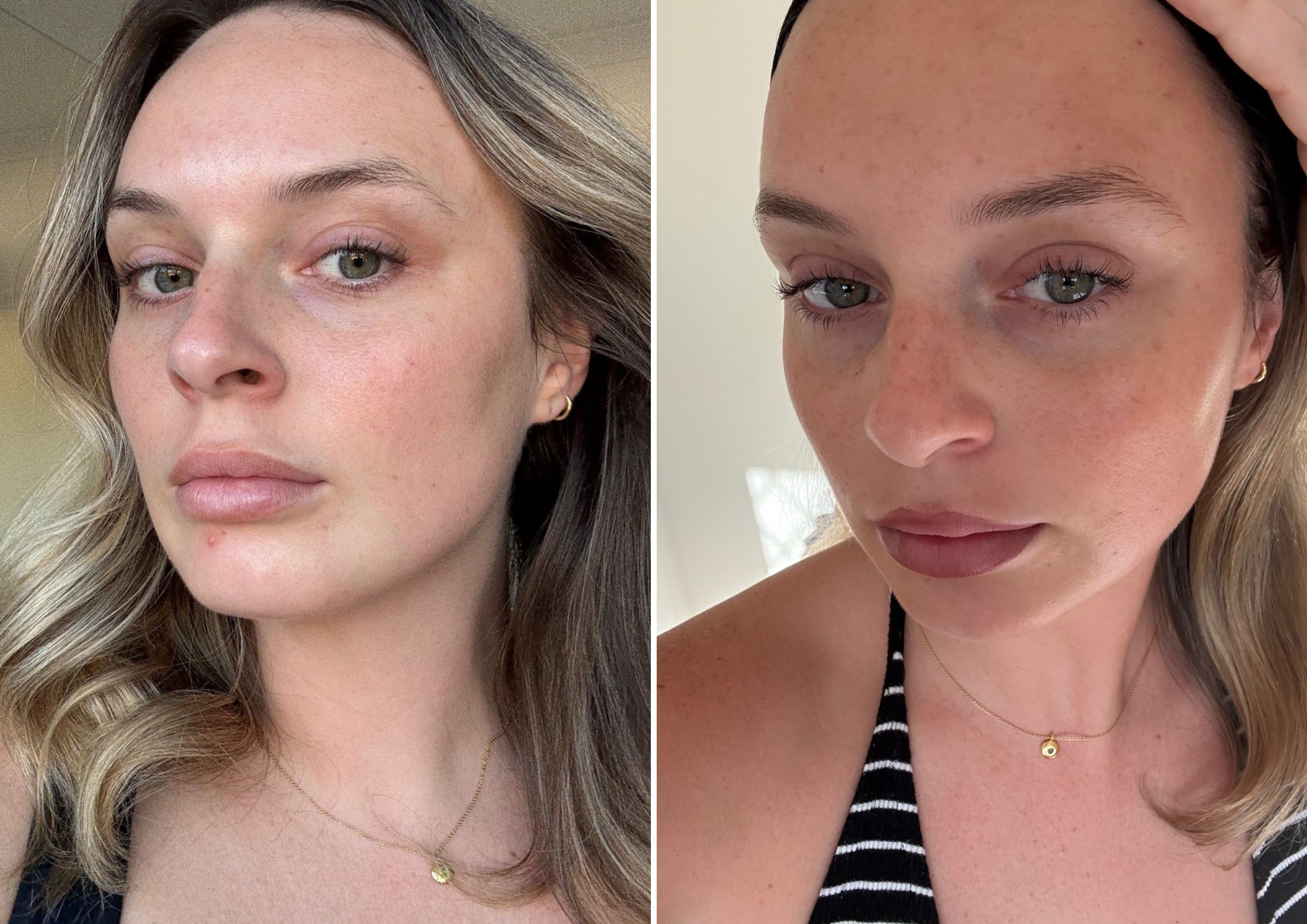 Abbey's Tatcha The Longevity Serum Before And After Abbey's Tatcha The Longevity Serum Before And After