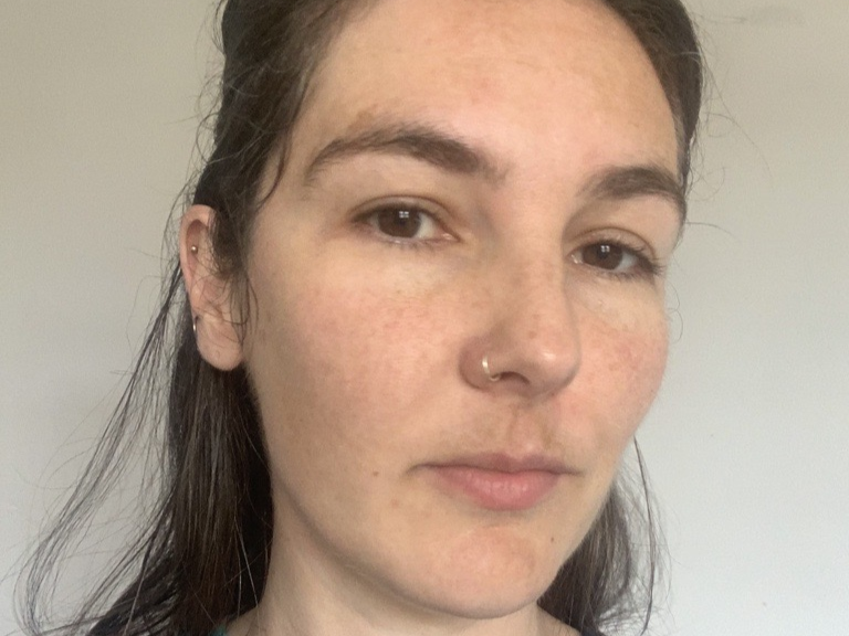 Kate Somerville Mega-C Brightening Facial Results | Space NK