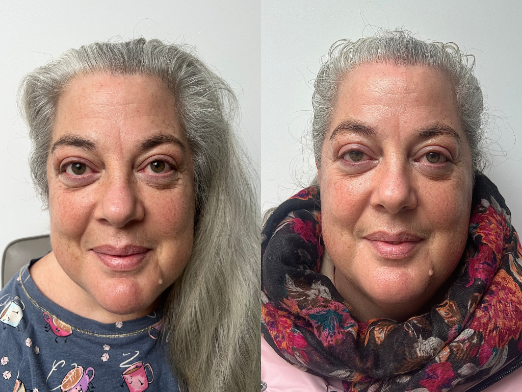 Before and after Skin Rocks The Rich Moisturiser | Space NK