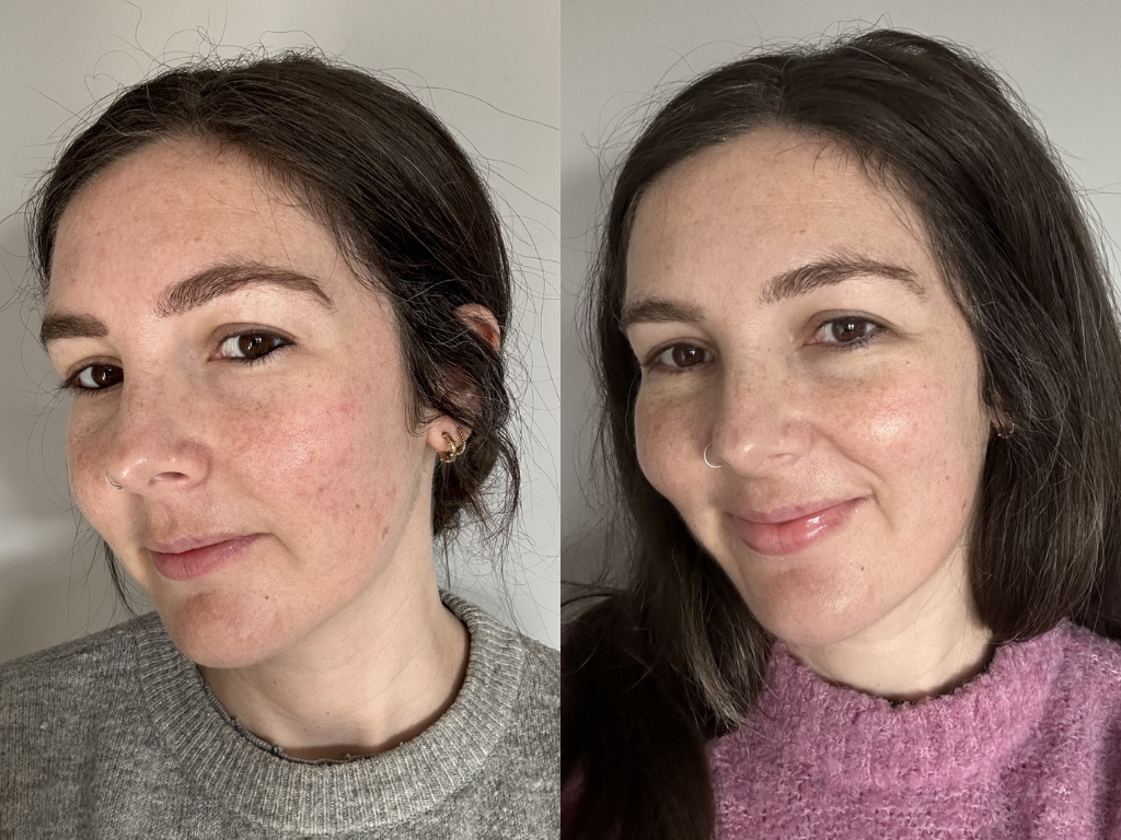 Before and after Creme de la Mer Moisturizing Cream | Space NK