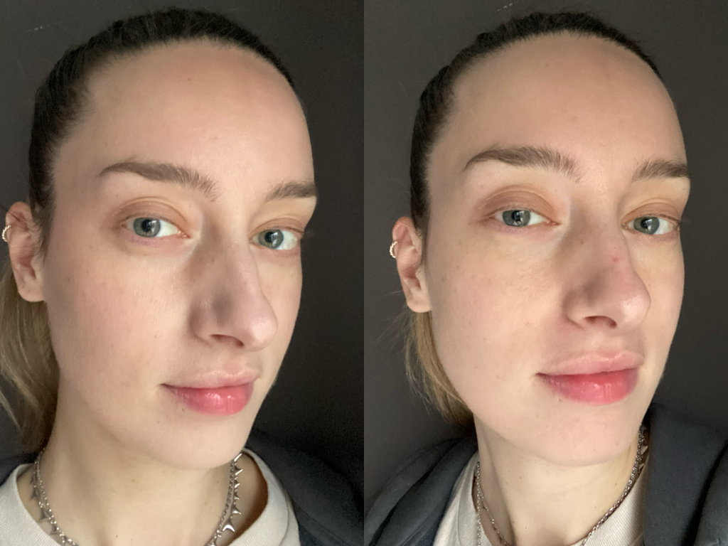 Before and after Erborian Super BB Concealer | Space NK Before and after Erborian Super BB Concealer | Space NK