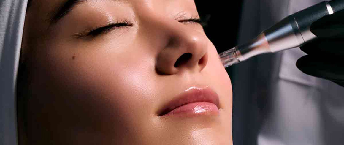 Chemical Peels