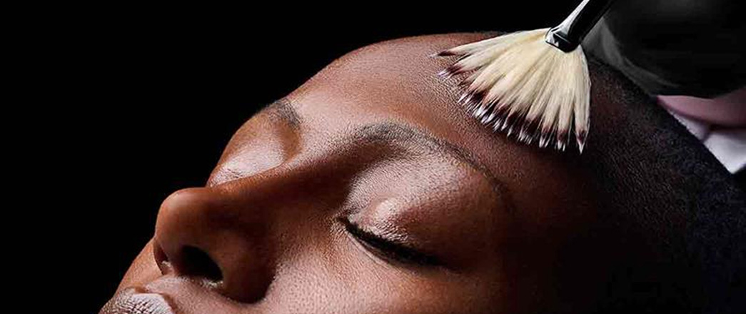 Microneedling