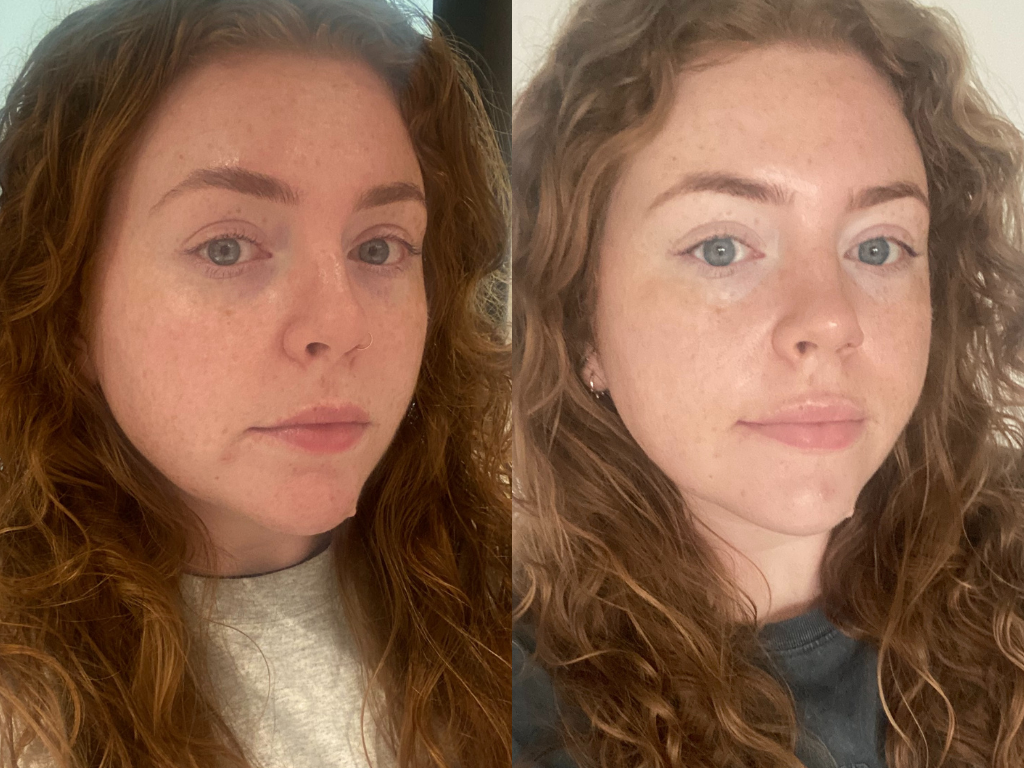 Before and after Caudalie Vinoperfect Serum | Space NK Before and after Caudalie Vinoperfect Serum | Space NK