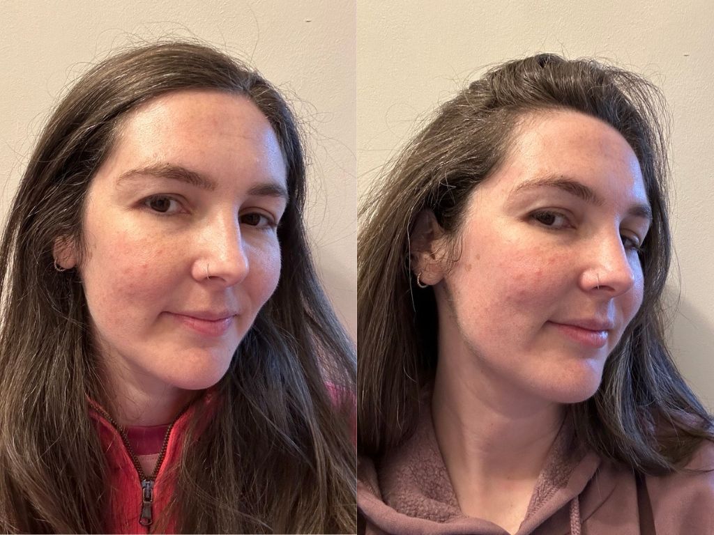 Paula's Choice BHA Liquid Exfoliant before and after | Space NK